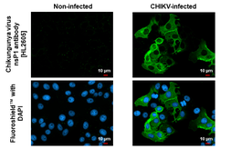 Anti-Chikungunya virus nsP1 antibody [HL2605] used in Immunocytochemistry/ Immunofluorescence (ICC/IF). GTX639057
